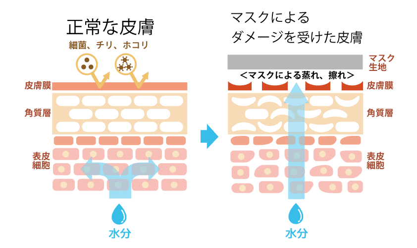 マスクによる肌へのダメージ