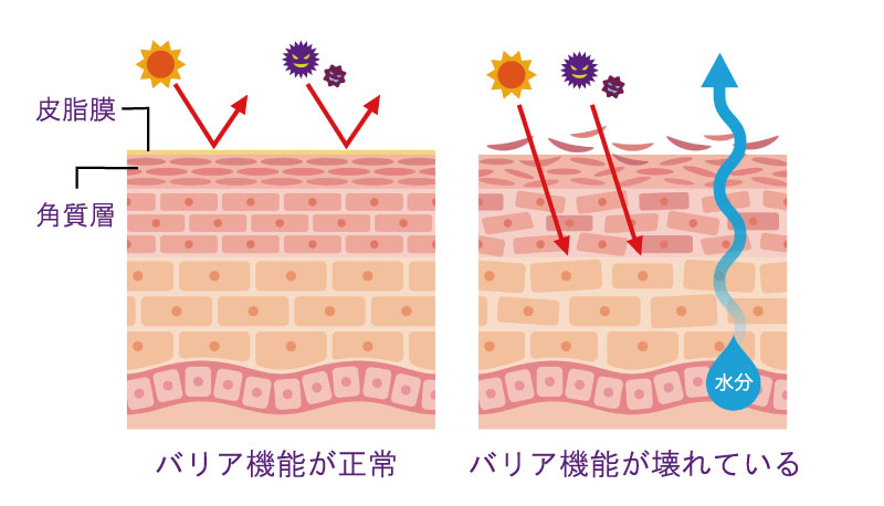 乾燥や外的刺激への敏感な反応は、皮脂膜と角質層のバリア機能が壊れると起こります。