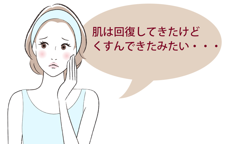 弱った肌が回復した後に、顔くすみが出ていることがあります。
