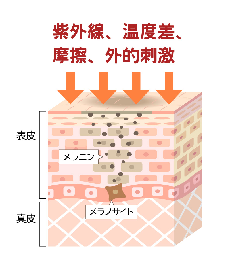 温度差、紫外線、摩擦、外的な刺激物