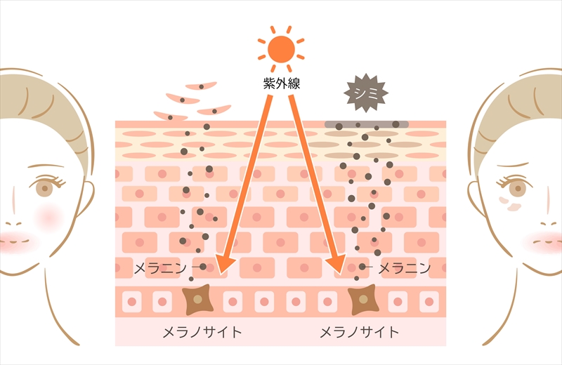 紫外線に用るトラブル