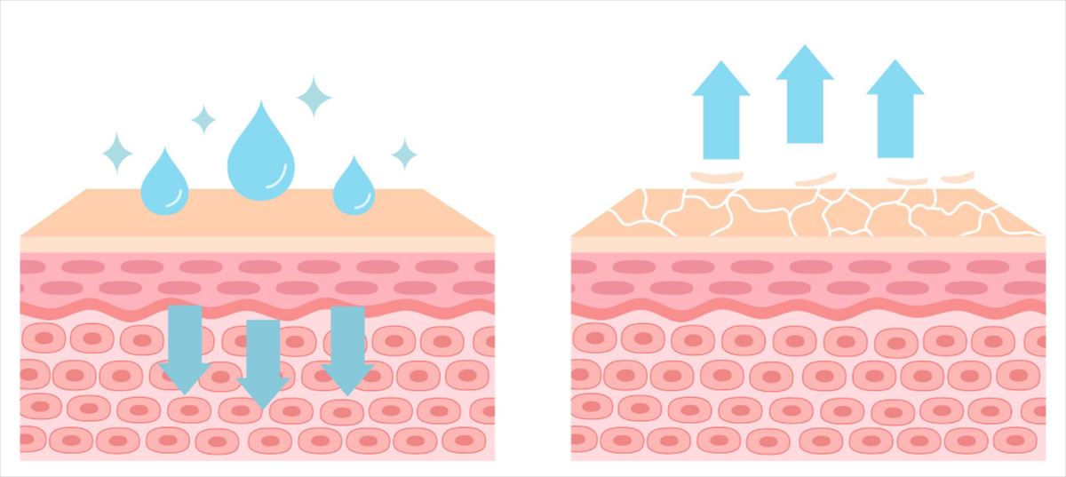 天然保湿因子（NMF）が減少すると、水分は保持できません