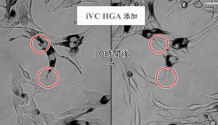 「iVC(アイブイシー)HGA」のメラニン輸送阻害