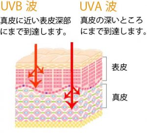 紫外線としみ、しわ