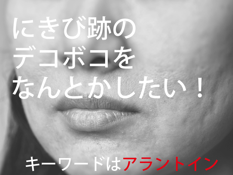 にきび跡のボコボコをなんとかしたい!