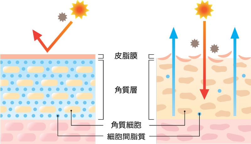 額は「脂腺」という皮脂を産生する器官が多く存在